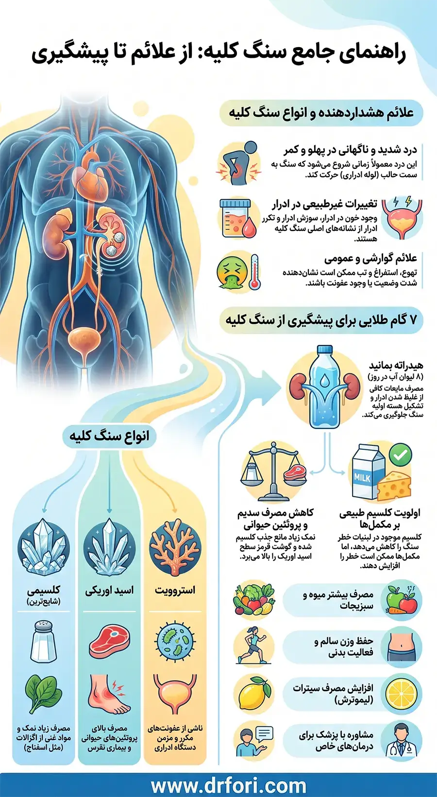 اینفوگرافیک سنگ کیه