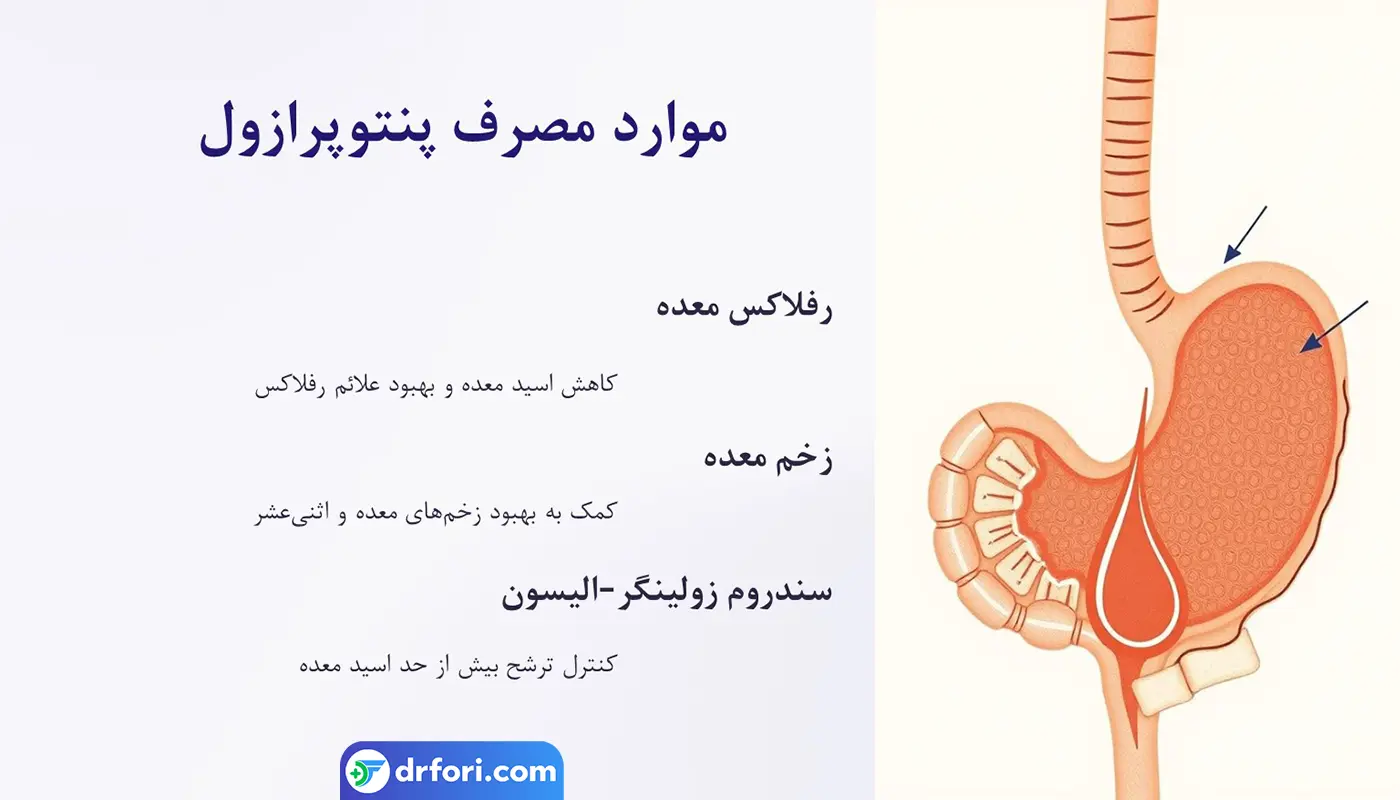 موراد مصرف پنتوپرازول