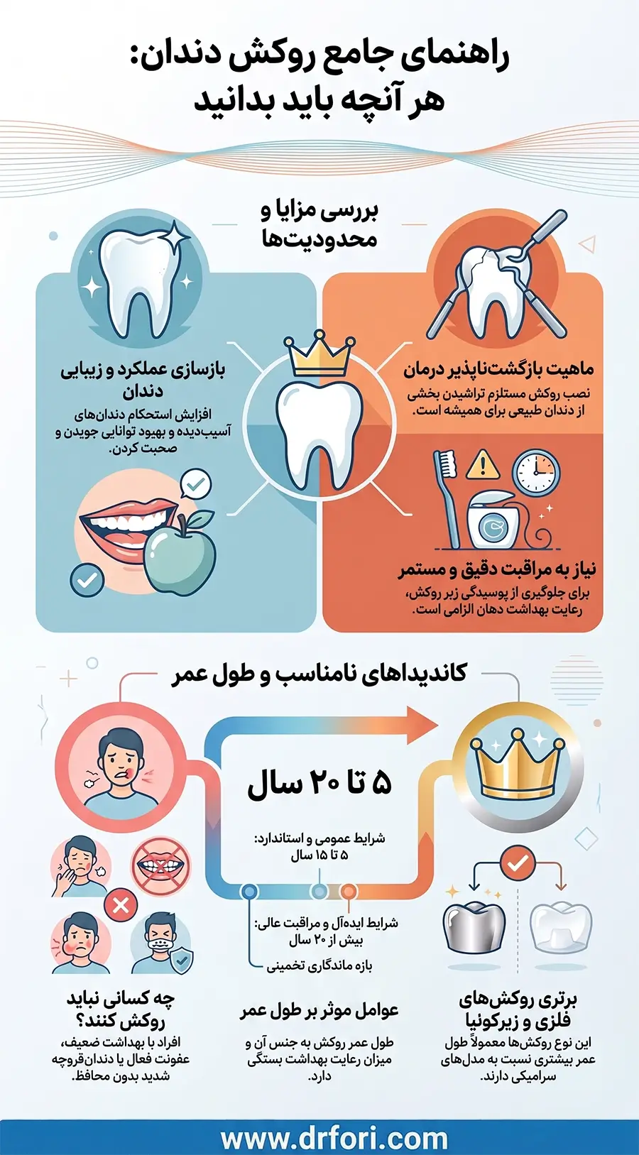 مزایا و معایب روکش دندان
