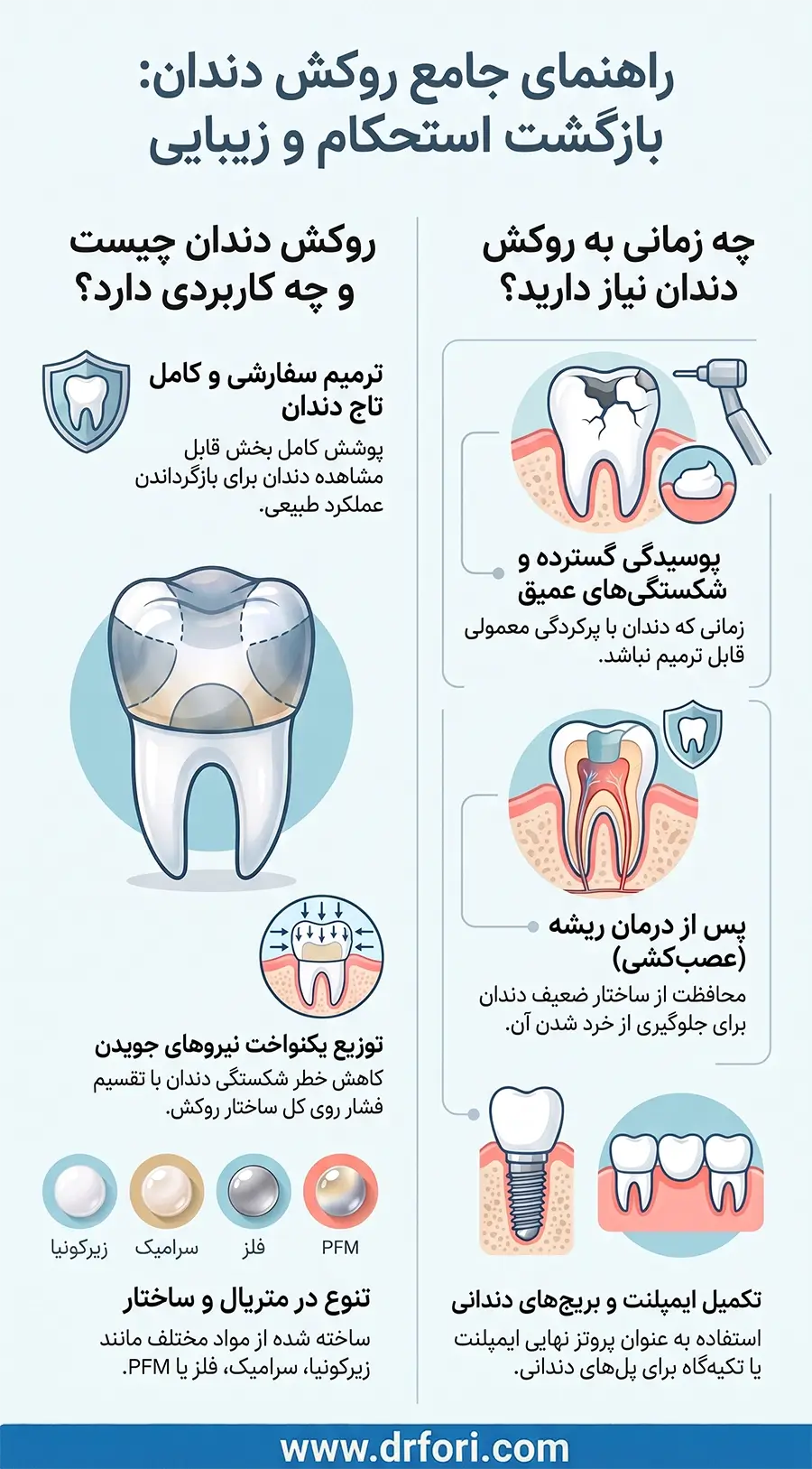 اینفوگرافیک روکش دندان