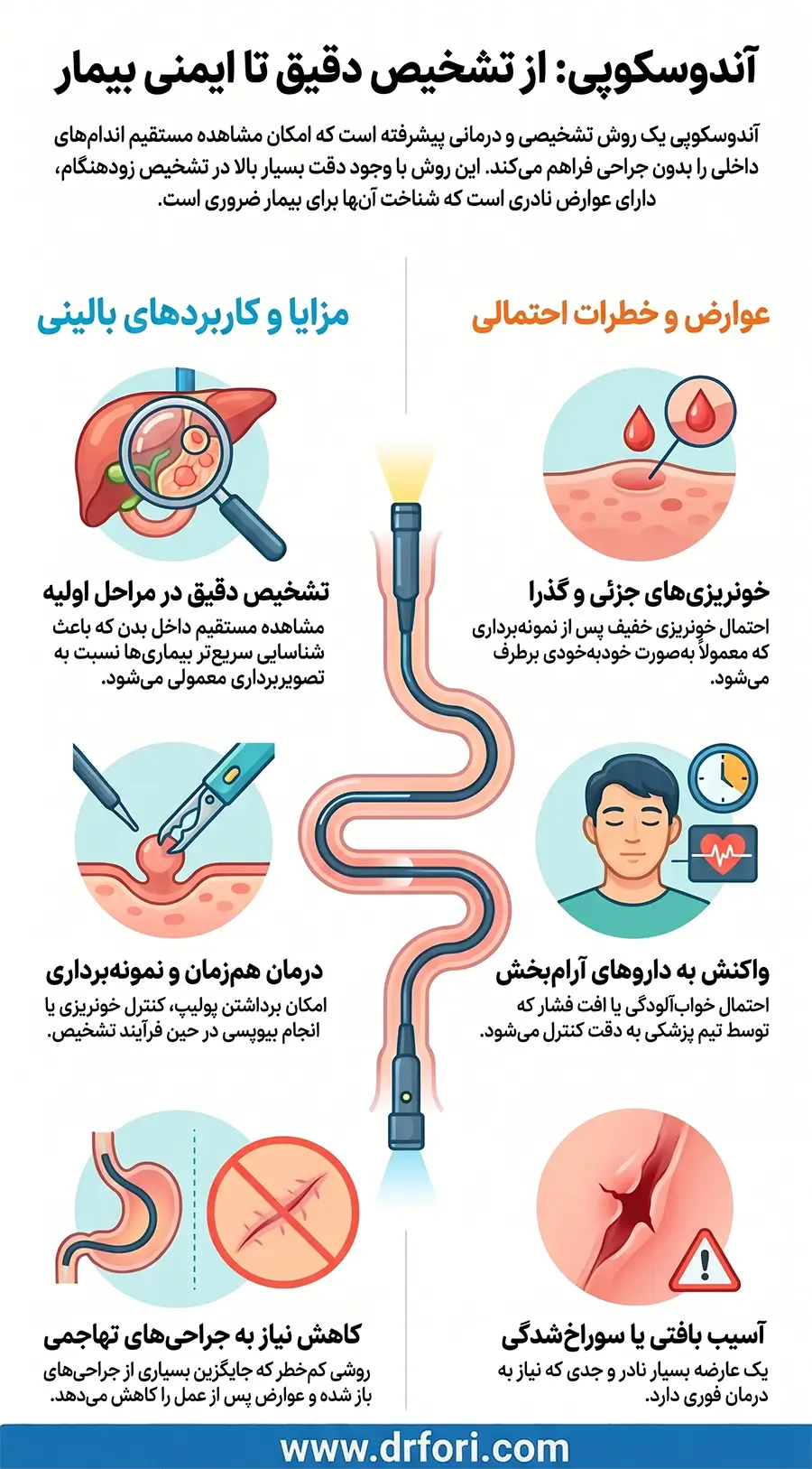 مزایا و عوارض آندوسکوپی