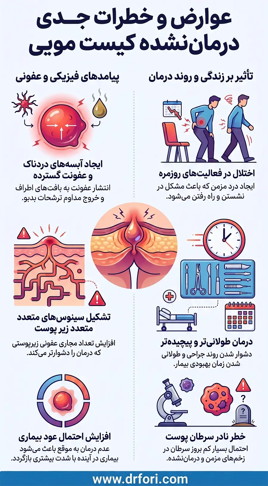 عوارض و خطرات کیست مویی