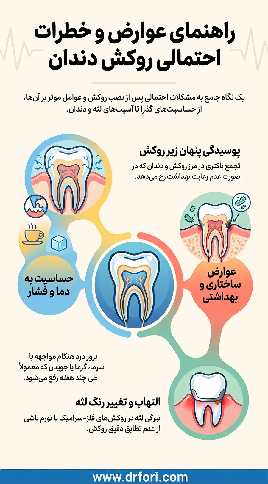 عوارض و خطرات روکش دندان