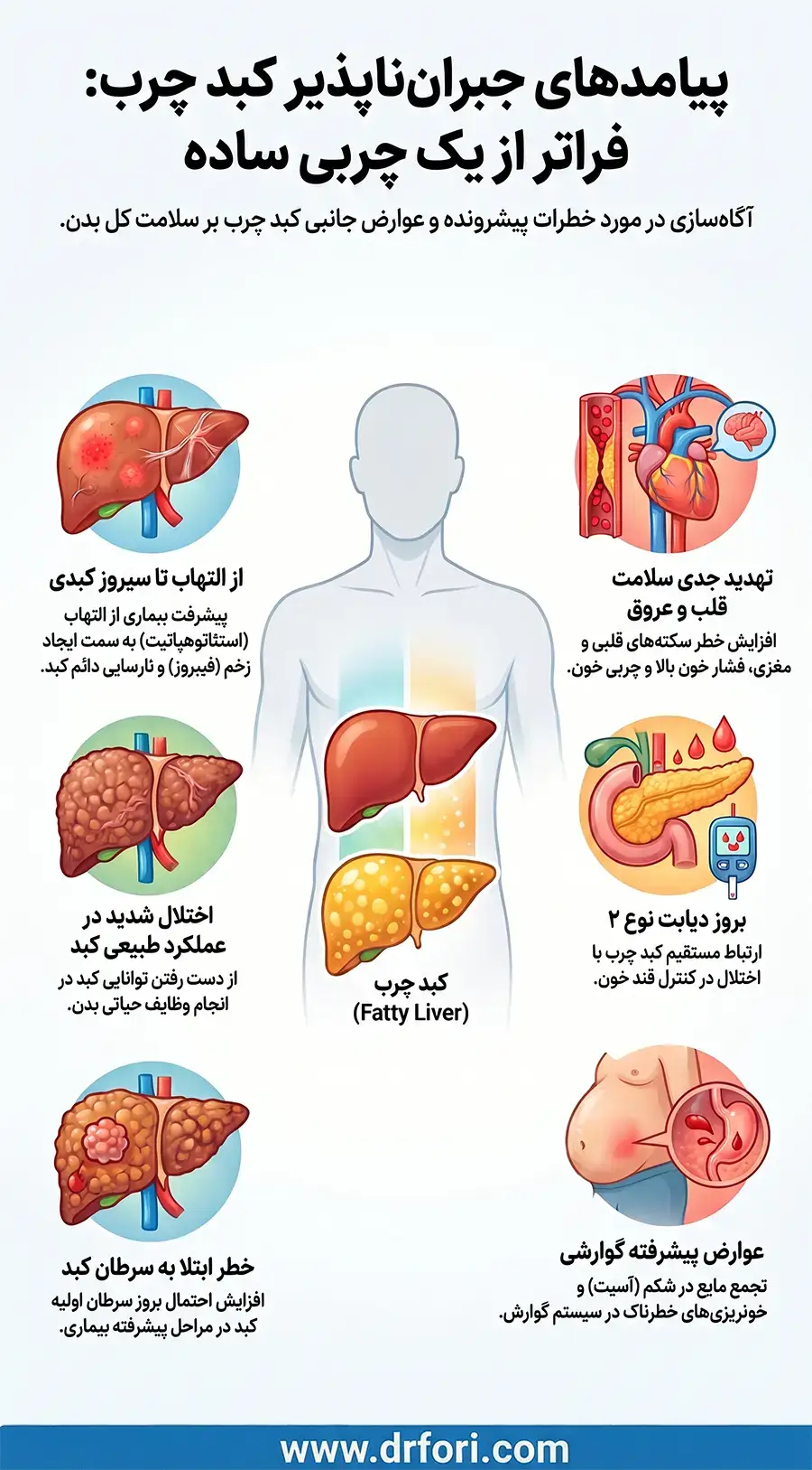 پیامدهای جبران ناپذیر کبد چرب