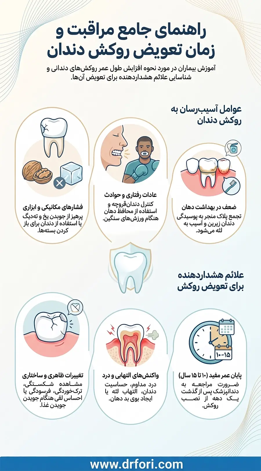 مراقبت و زمان تعویض روکش دندان