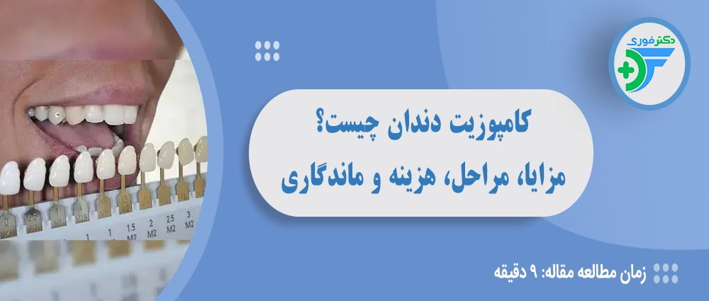 کامپوزیت دندان چیست؟ مزایا، مراحل، هزینه و ماندگاری