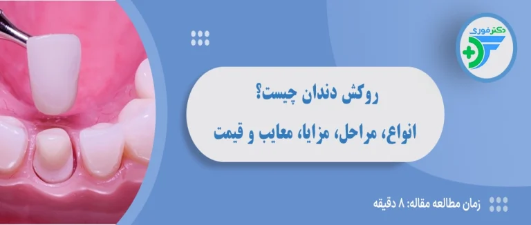 روکش دندان چیست؟ راهنمای کامل انواع، مراحل، مزایا، معایب و قیمت