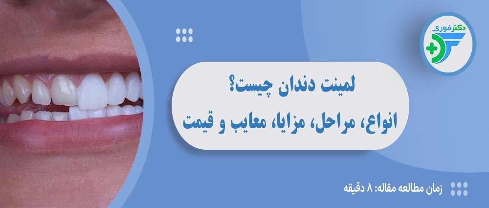 لمینت دندان چیست؟ راهنمای کامل انواع، مراحل، مزایا، معایب و قیمت