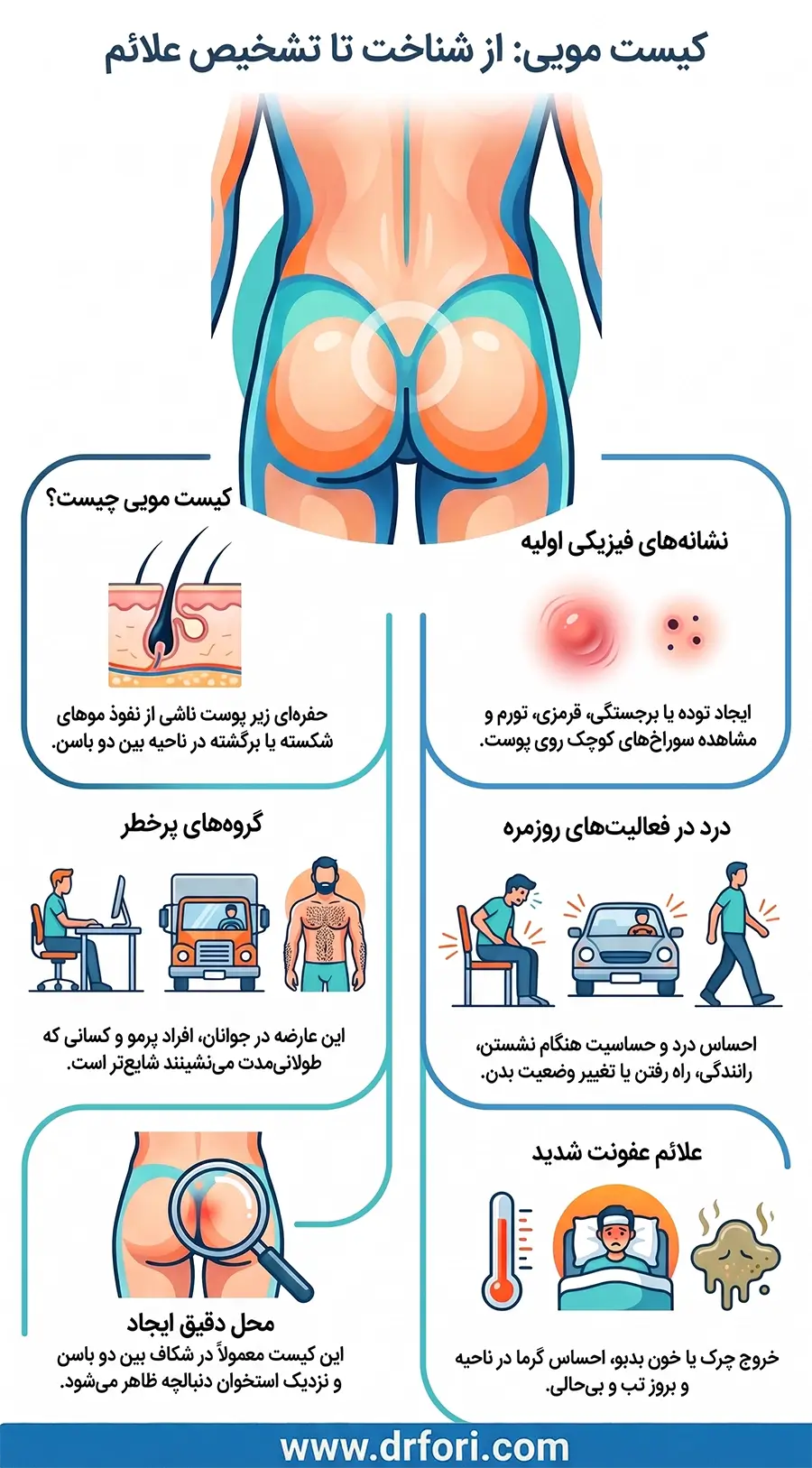 شناخت تا تشخیص علائم کیست مویی