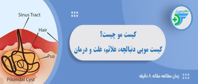کیست مو چیست؟ راهنمای کامل کیست مویی دنبالچه، علائم، علت و درمان