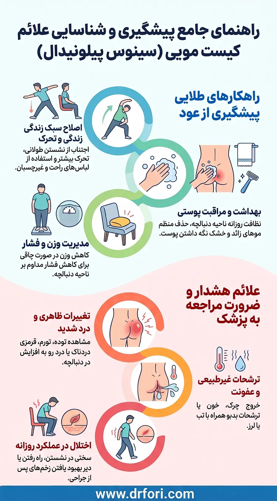 پیشگیری از کیست مویی