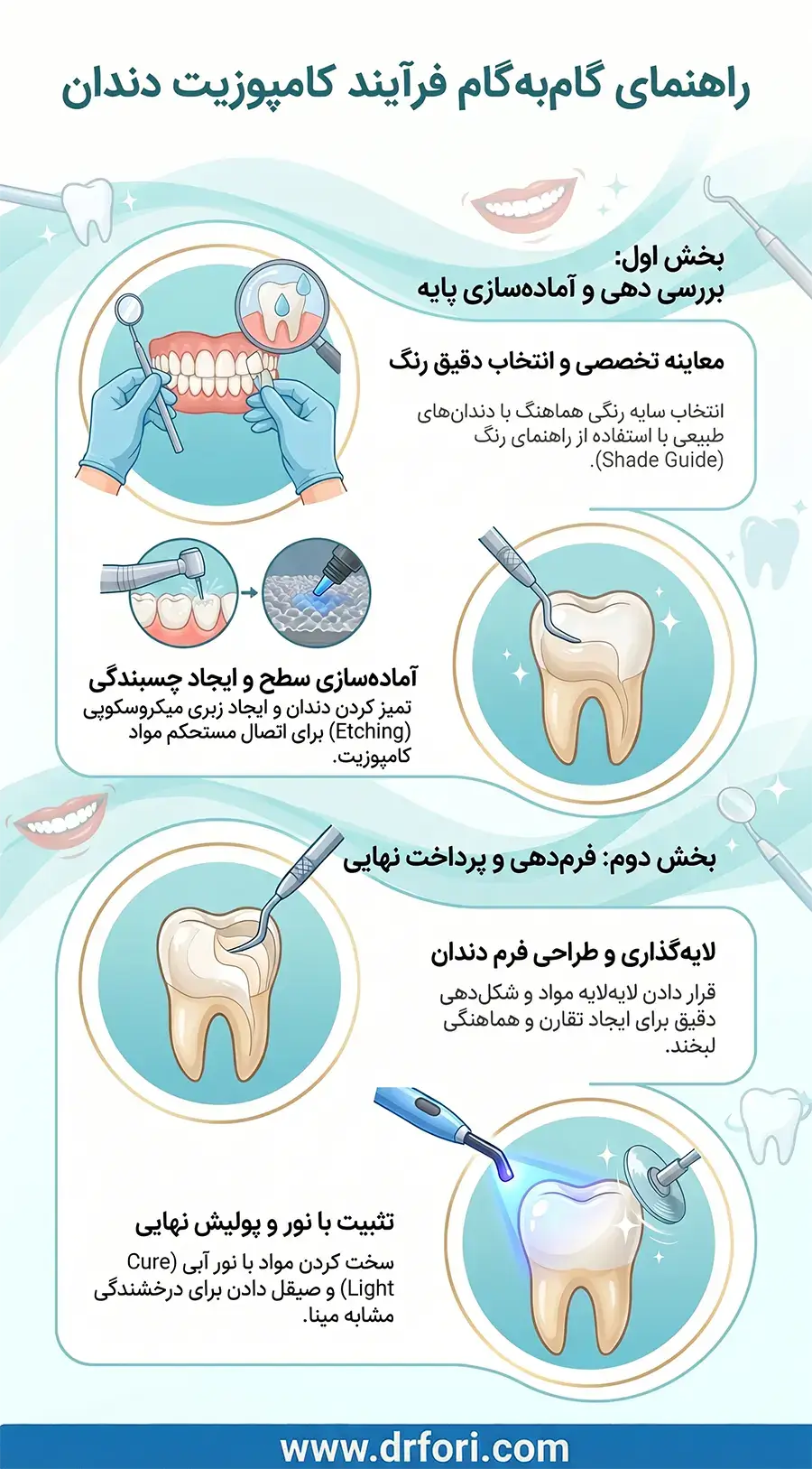 راهنمای فرایند کامپوزیت دندان