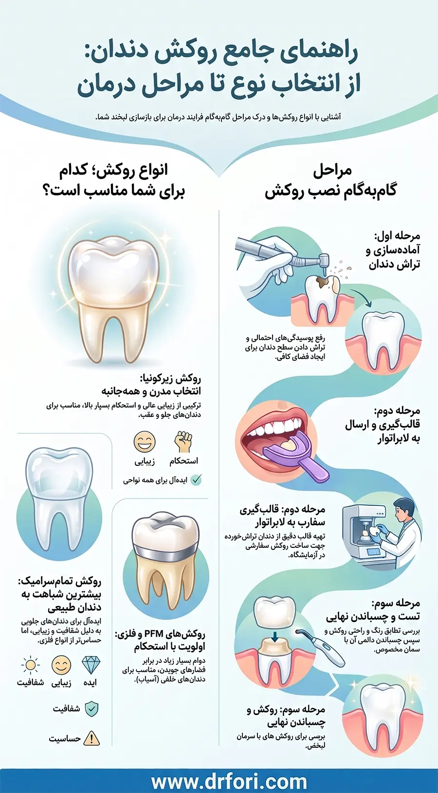 انواع روکش دندان و مراحل نصب