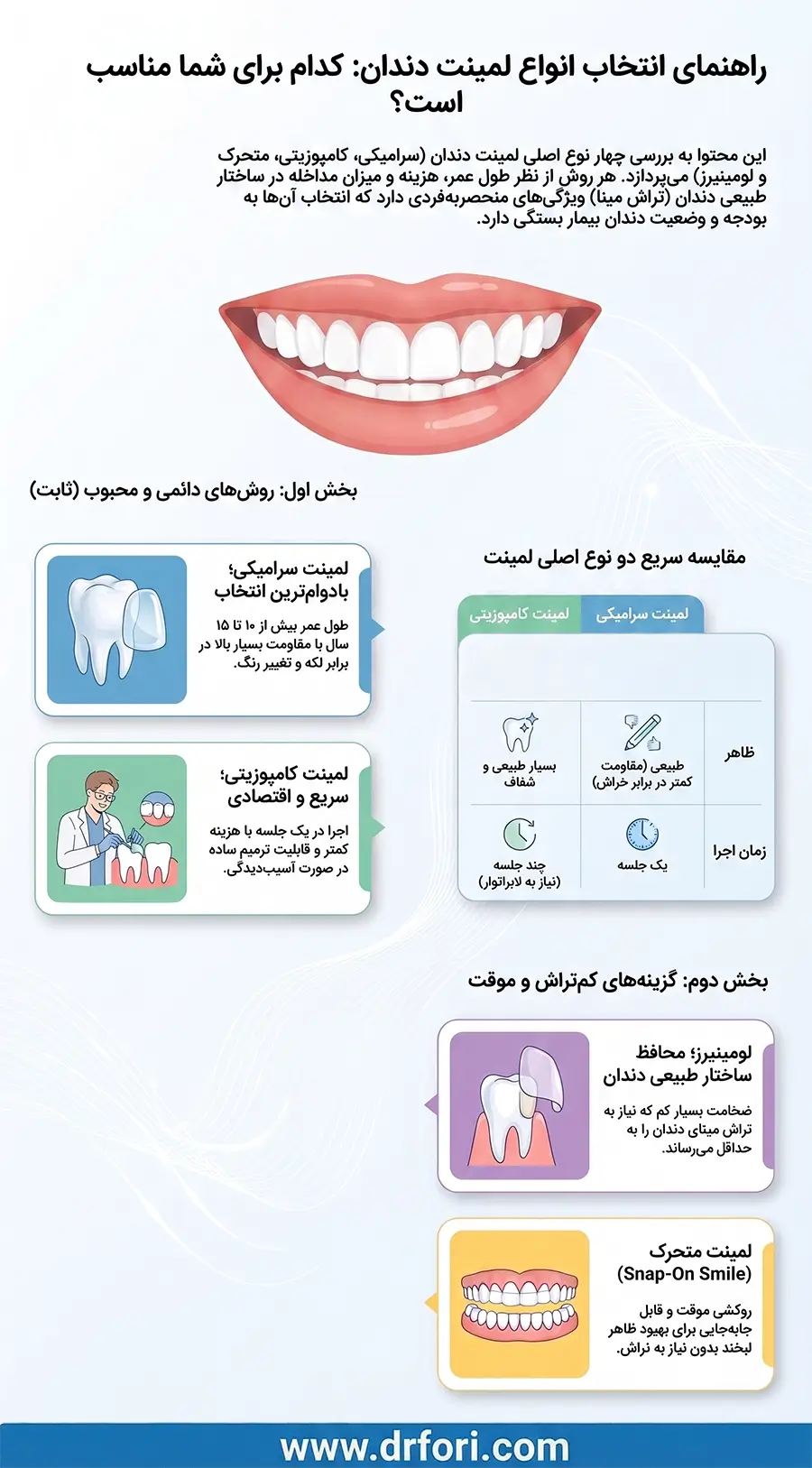 انواع لمینت دندان