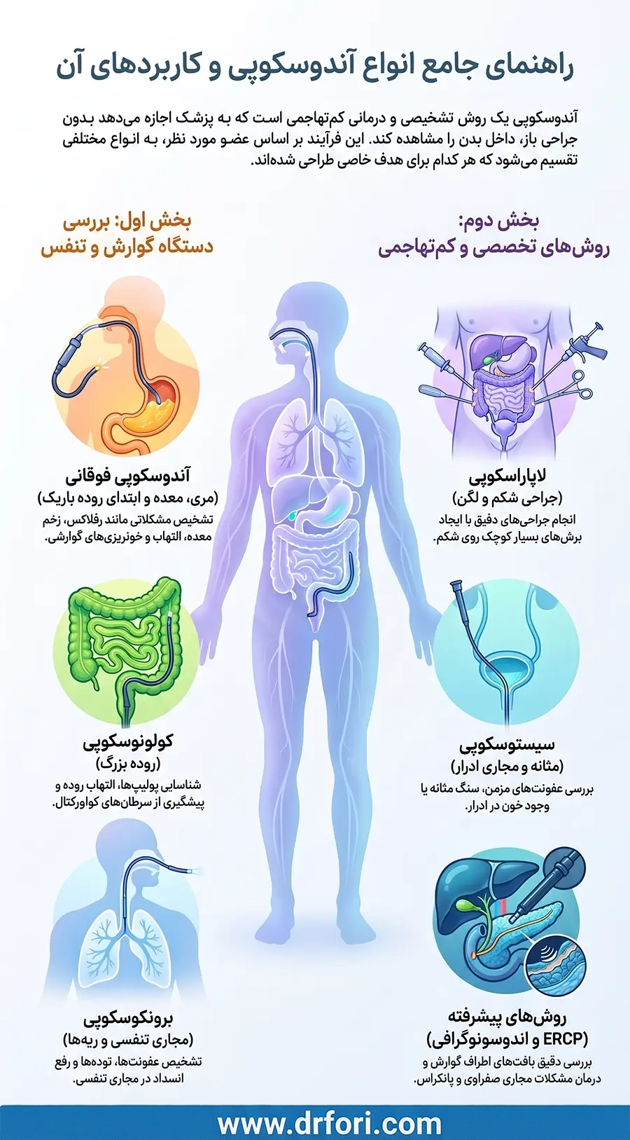 انواع آندوسکوپی