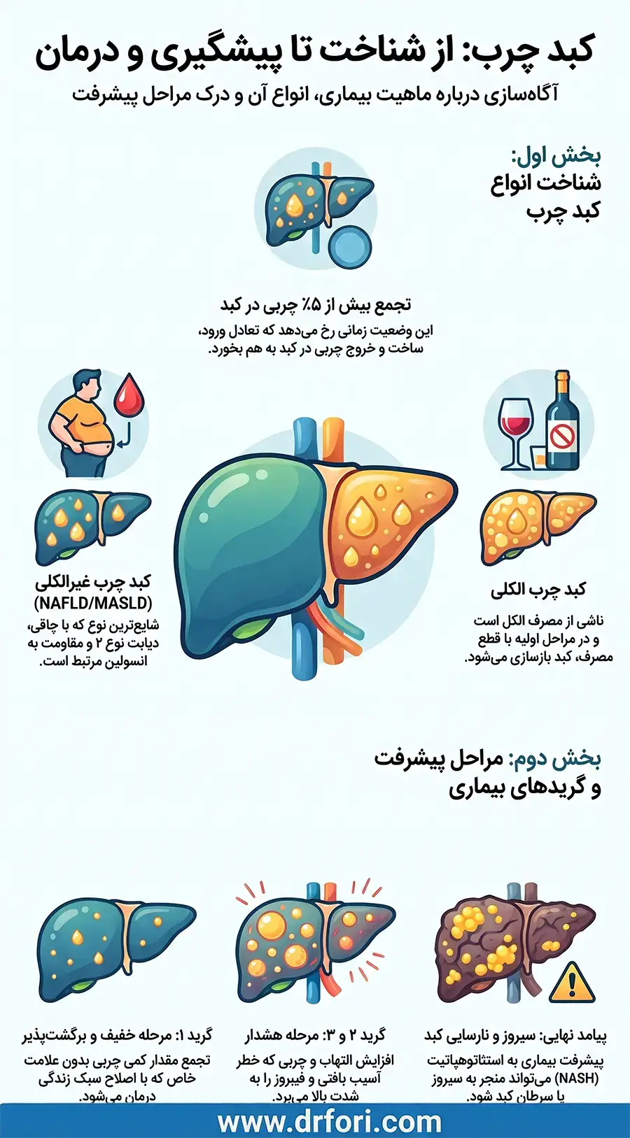 کبد چرب: از شناخت تا پیگیری و درمان