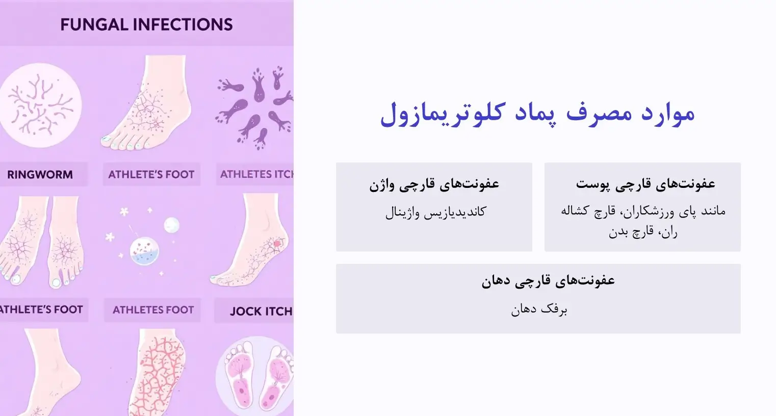 کاربرد پماد کلوتریمازول