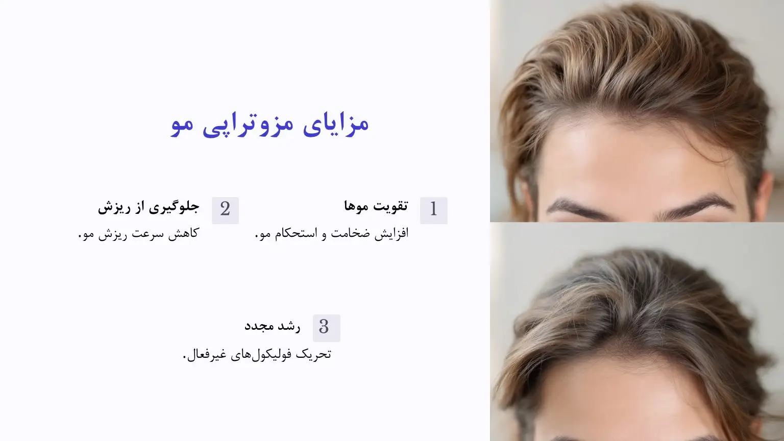 مزایای مزوتراپی مو