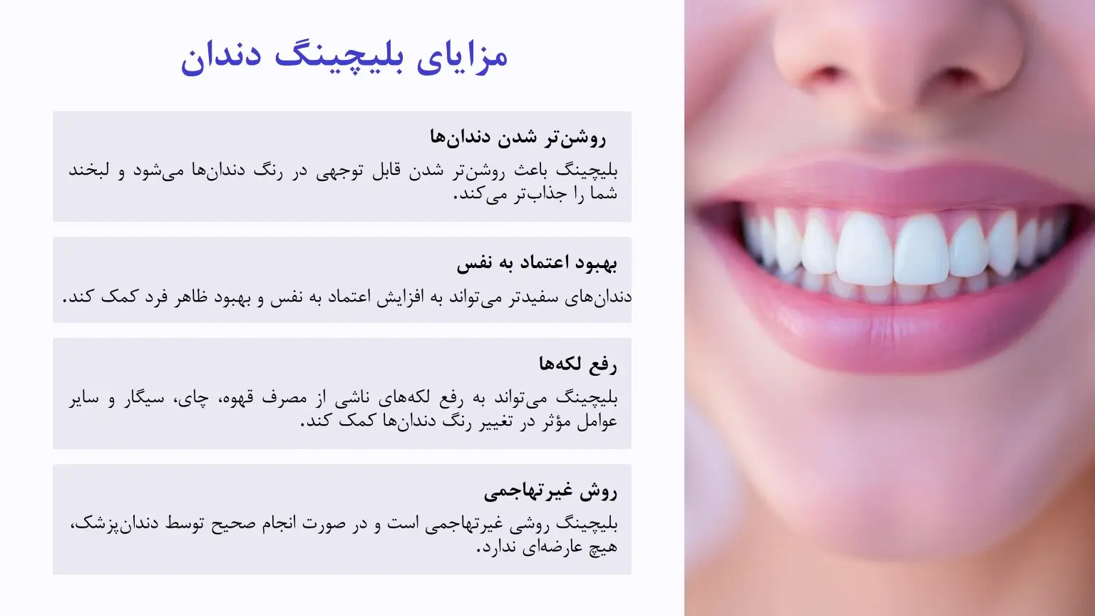 مزایای بلیچینگ دندان