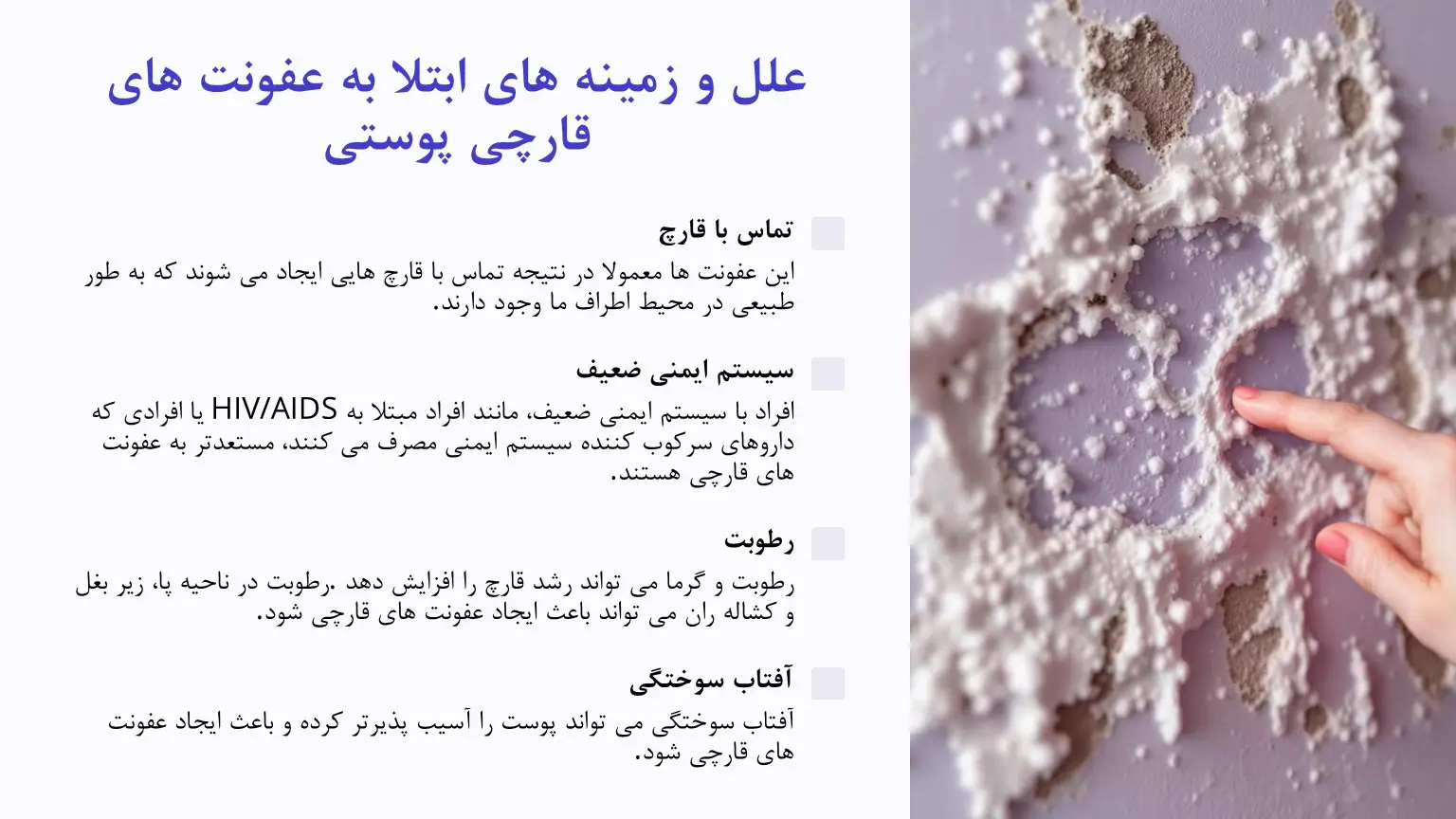 علت قارچ پوستی
