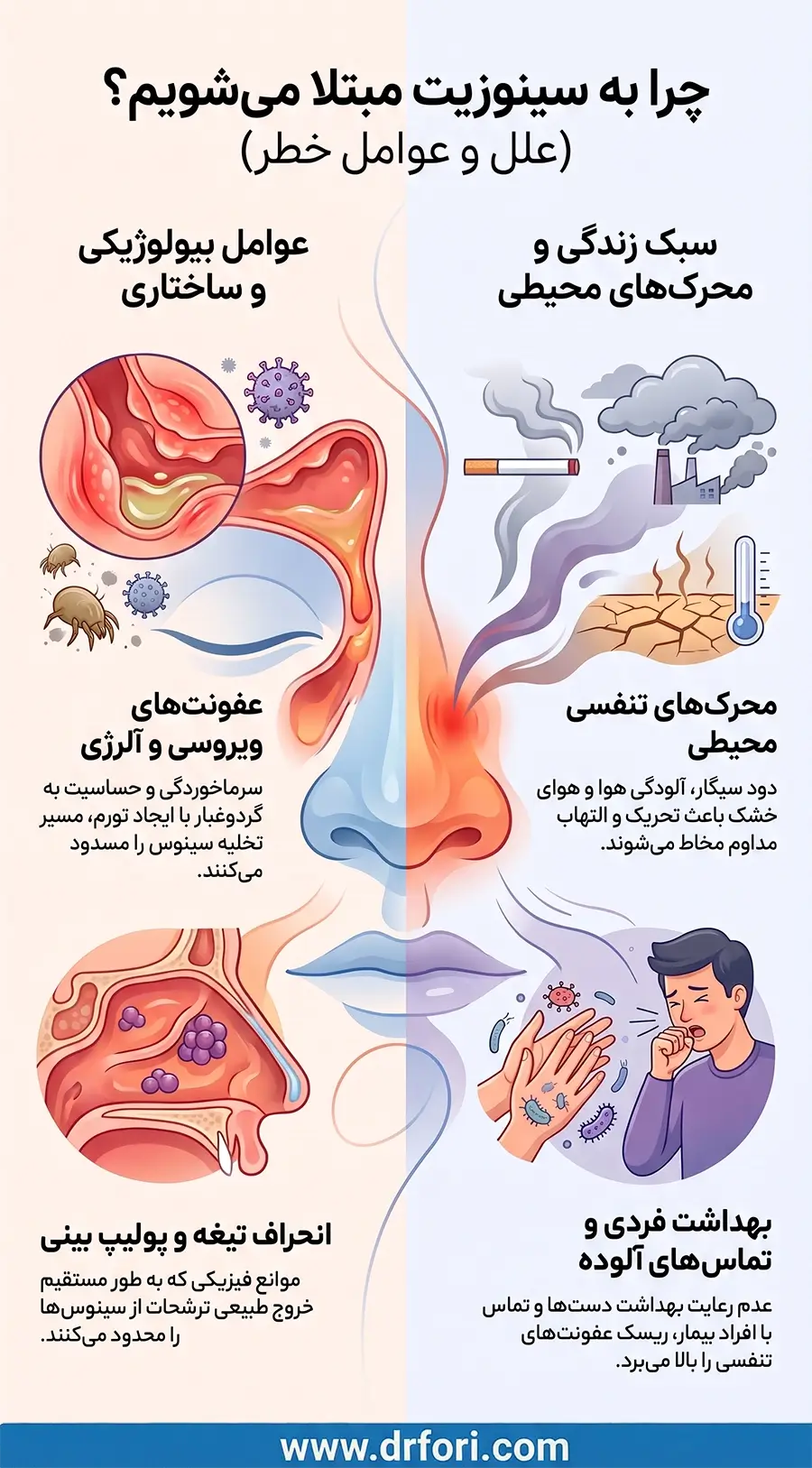 علت سینوزیت و عوامل خطر