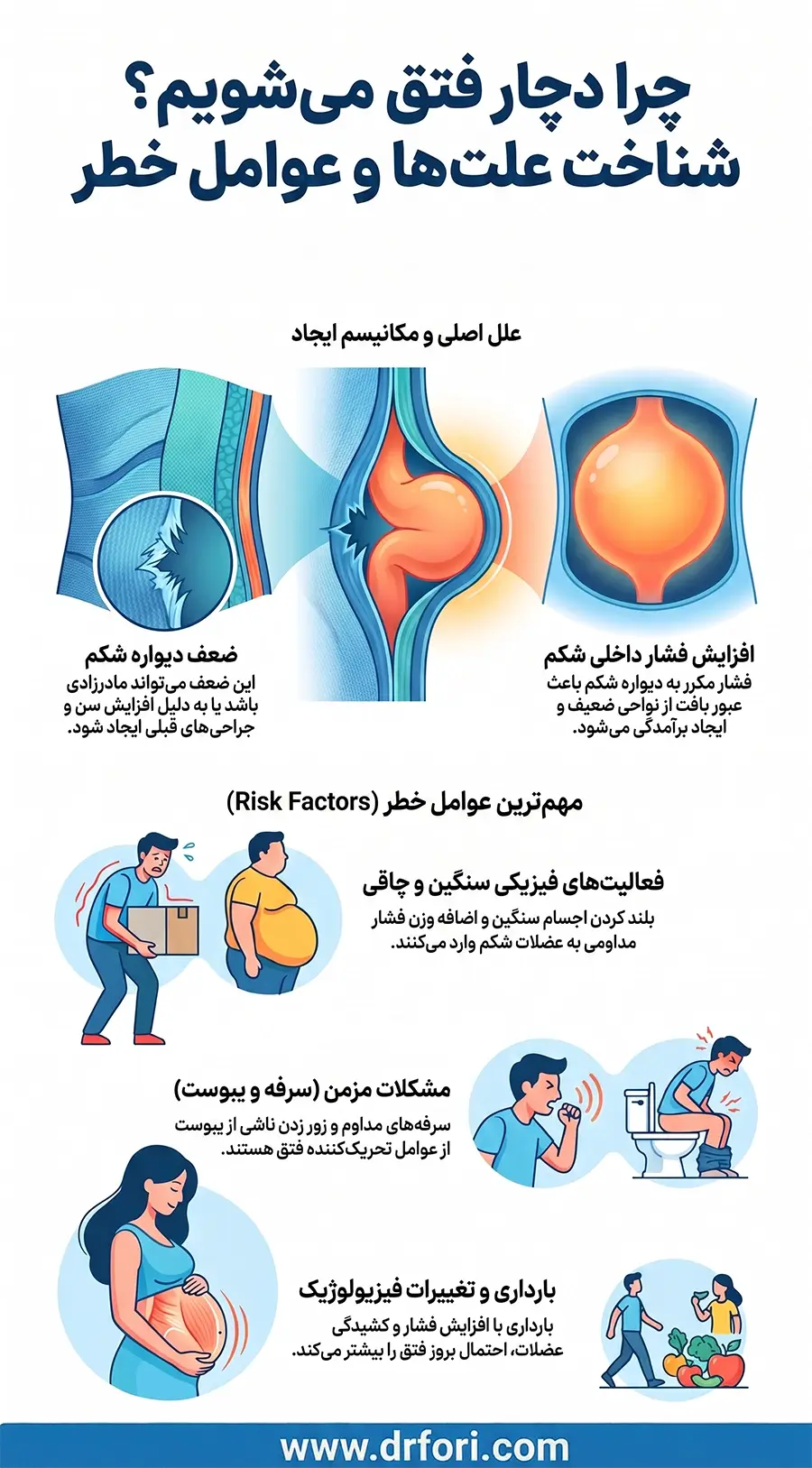 علت ایجاد فتق و عوامل خطر