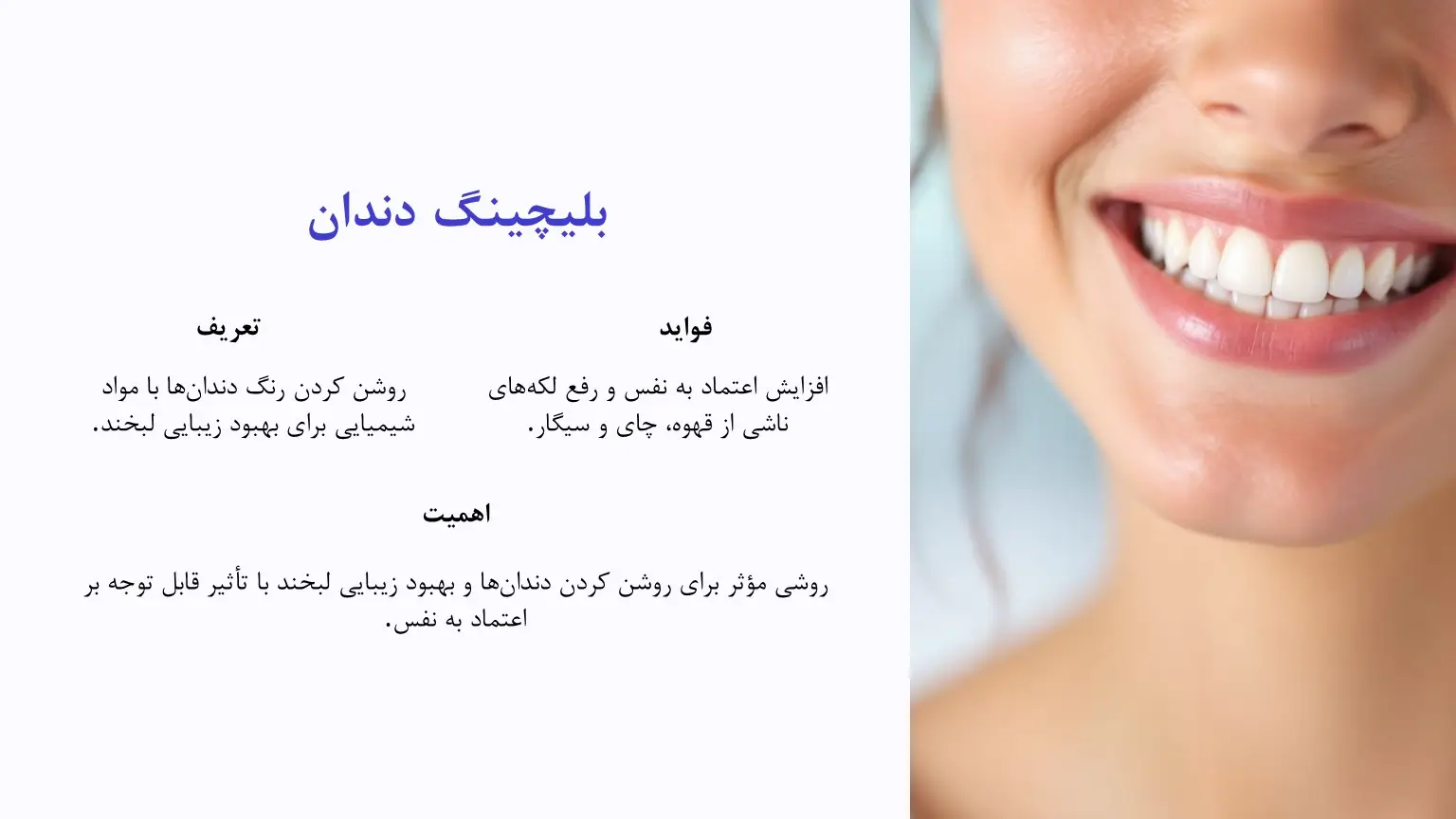 معرفی بلیچینگ دندان