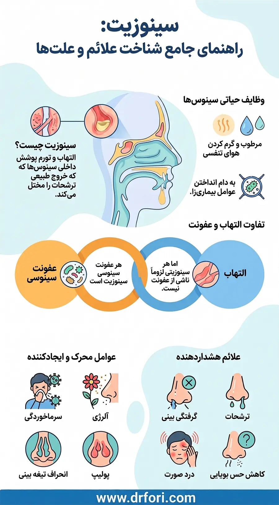 راهنمای جامع سینوزیت