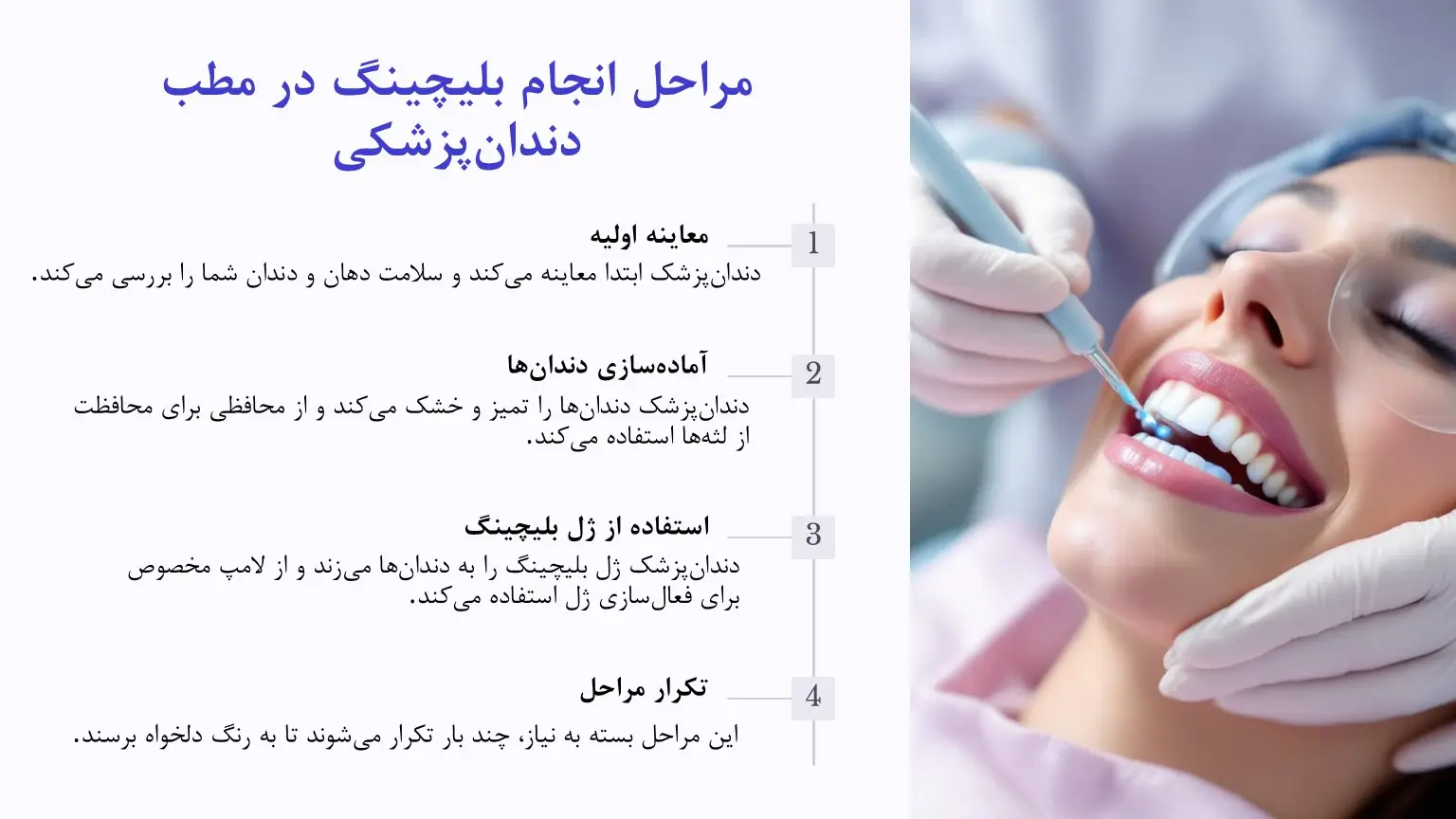 مراحل انجام بلیچینگ دندان
