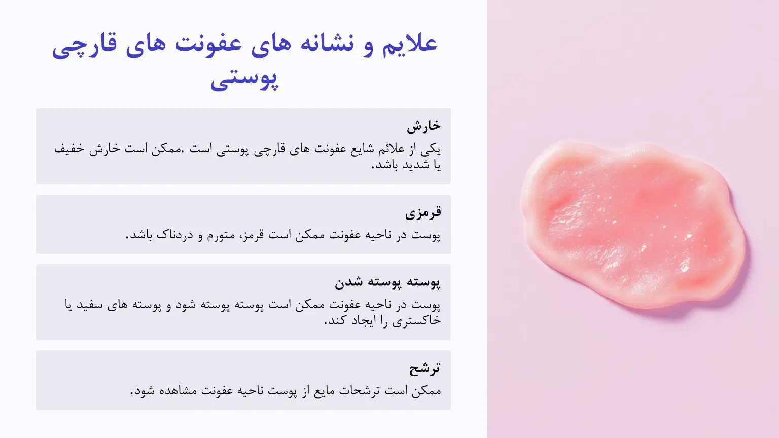 علائم و نشانه های قارچ پوستی