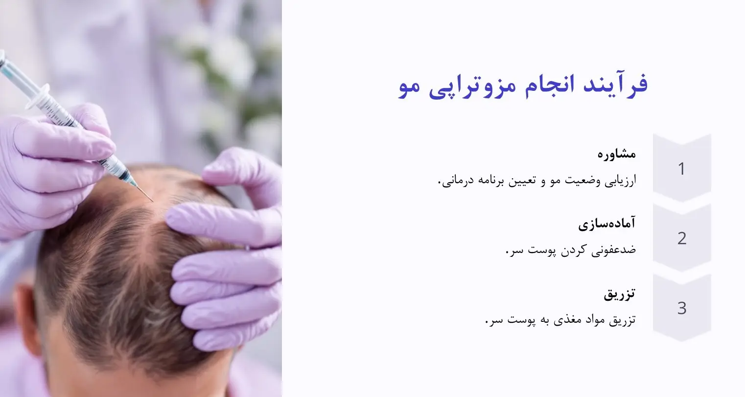 مراحل انجام مزوتراپی مو