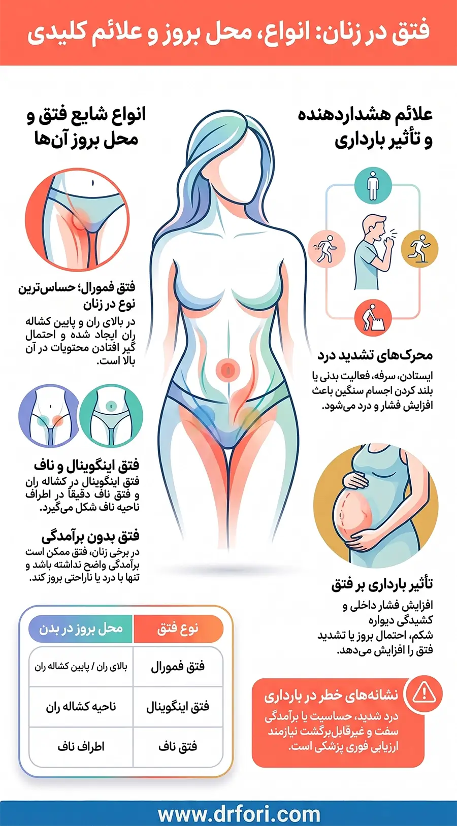فتق در زنان