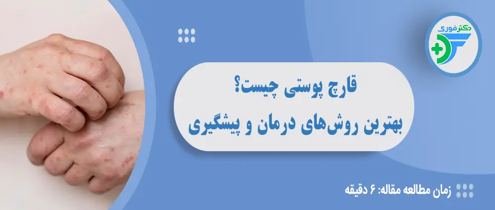 قارچ پوستی چیست و چگونه درمان می‌شود؟