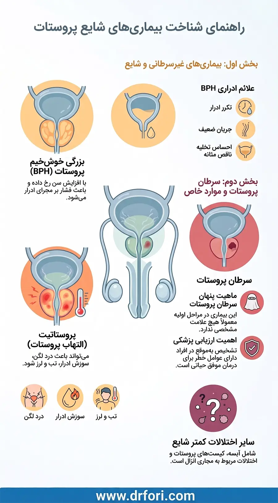 بیماریهای شایع پروستات