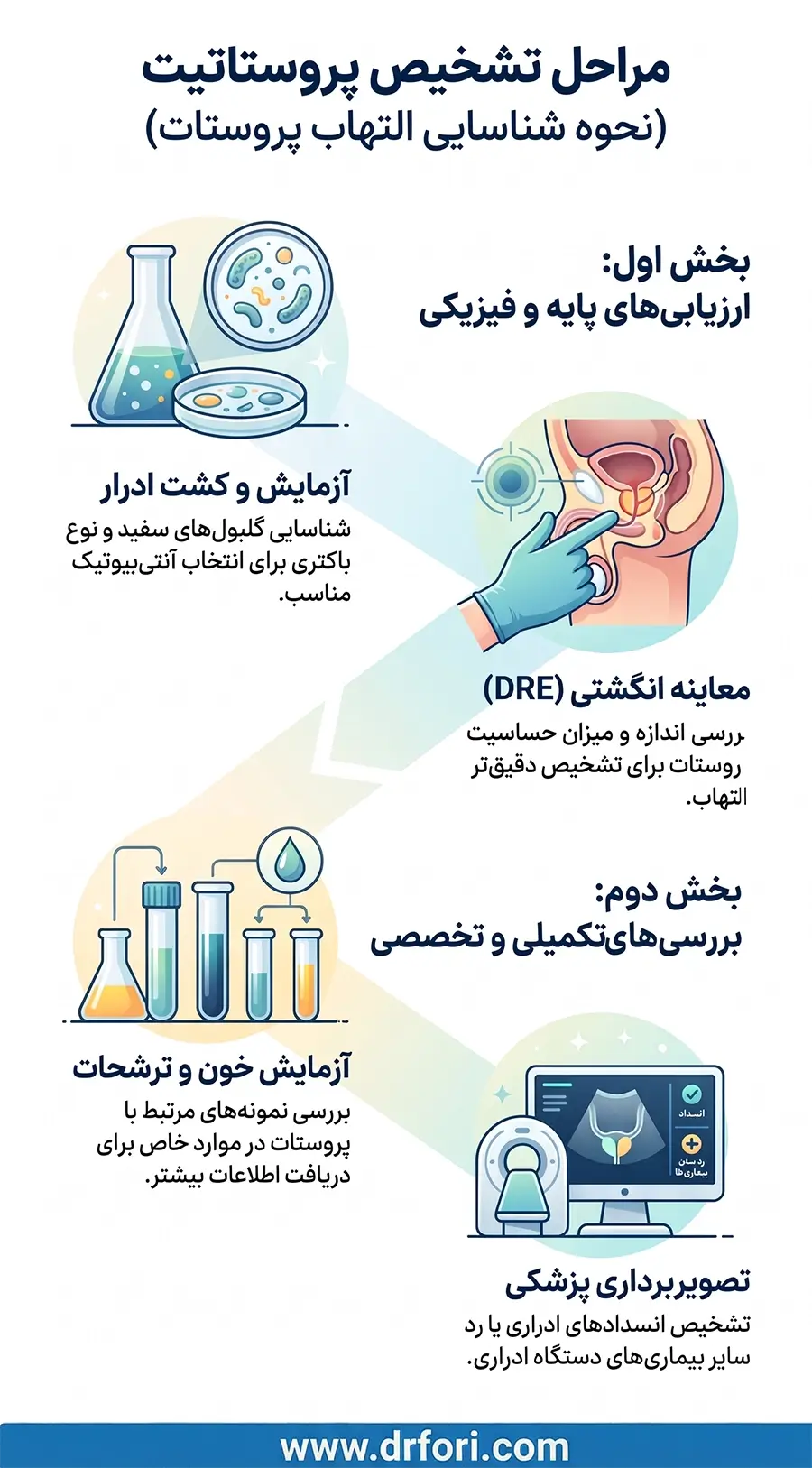 تشخیص پروستات