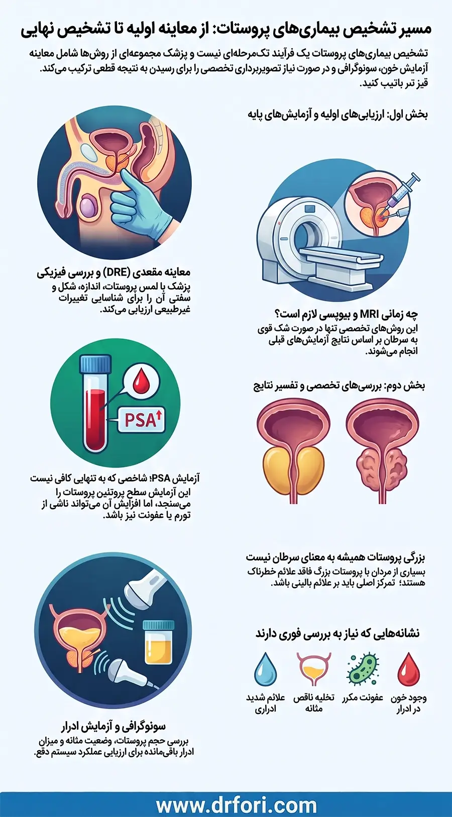 بررسی و تشخیص بیماری های پروستات