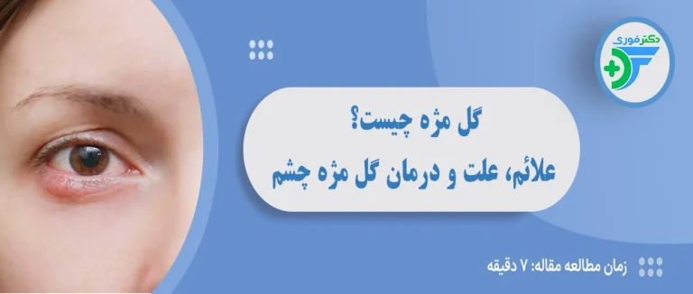 گل مژه چیست؟ علائم، علت، درمان خانگی و پزشکی گل مژه چشم