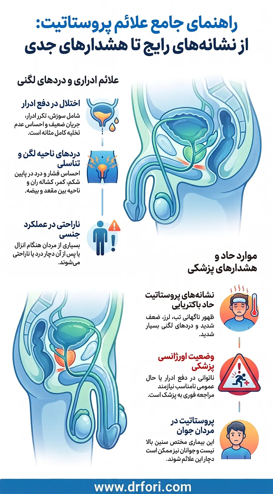 علائم پروستاتیت