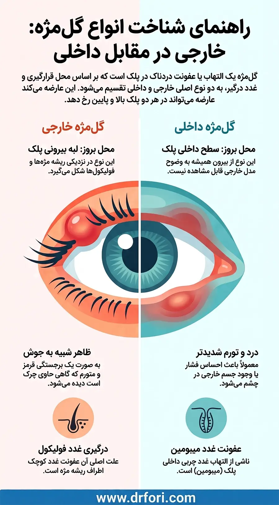 انواع گل مژه