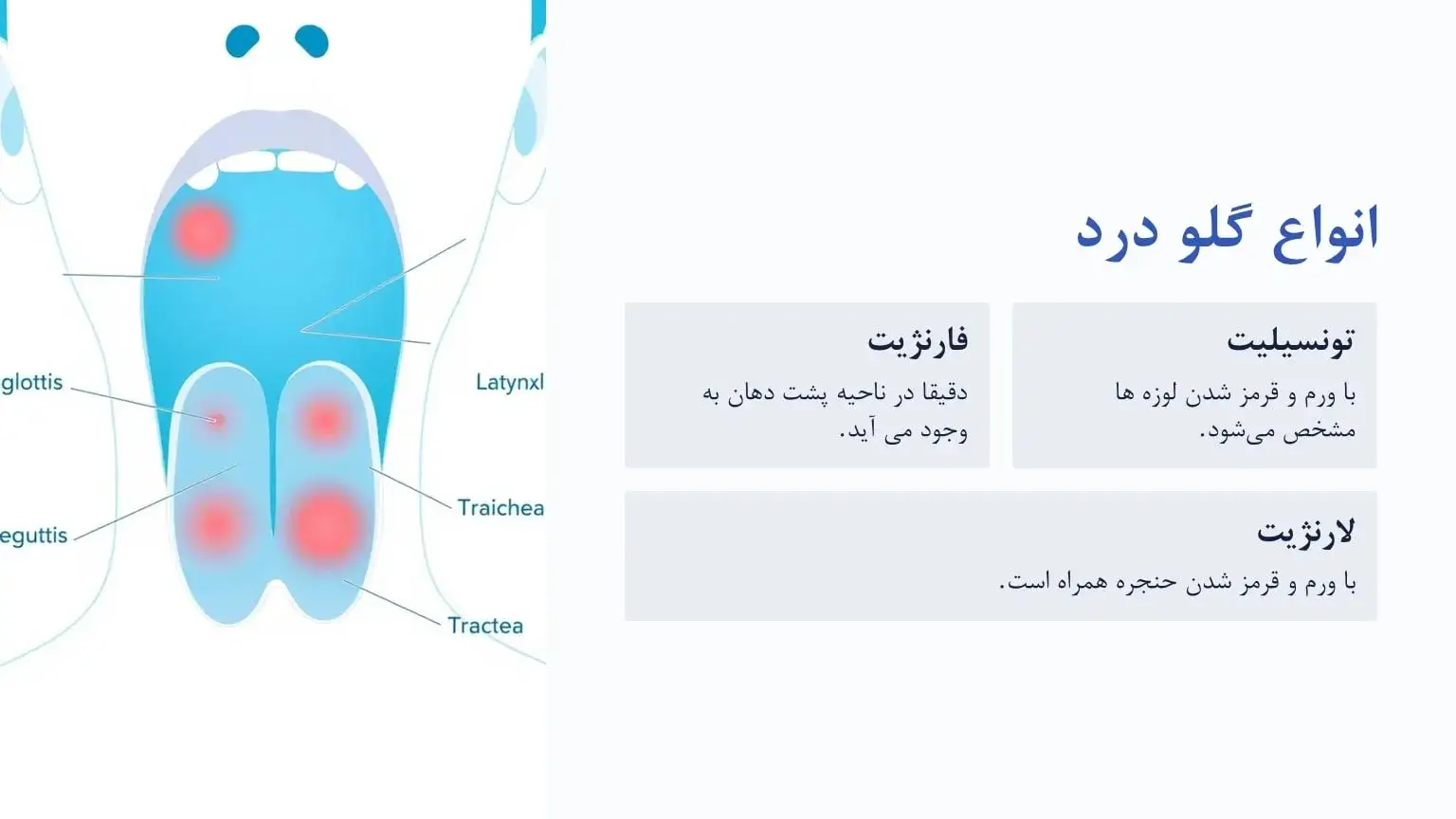 انواع گلو درد