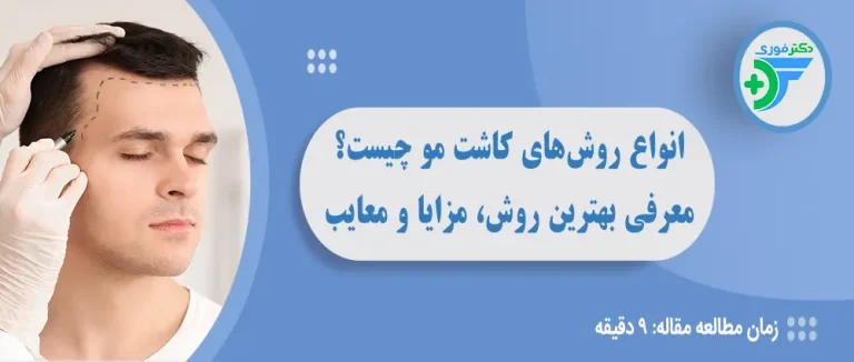 انواع روش‌های کاشت مو چیست؟ معرفی بهترین روش، مزایا، معایب و هزینه آن