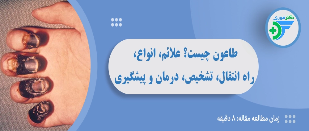 طاعون چیست؟ علائم، انواع، راه انتقال، تشخیص، درمان و پیشگیری
